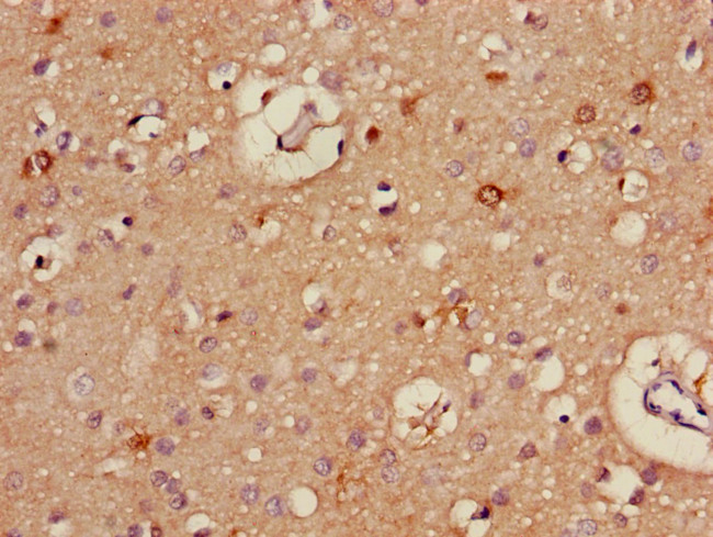 ALDH5A1 Antibody in Immunohistochemistry (Paraffin) (IHC (P))