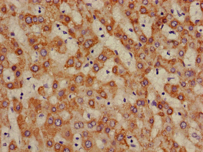 ALDH5A1 Antibody in Immunohistochemistry (Paraffin) (IHC (P))