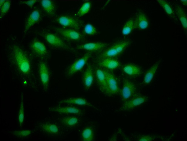 ALDH7A1 Antibody in Immunocytochemistry (ICC/IF)