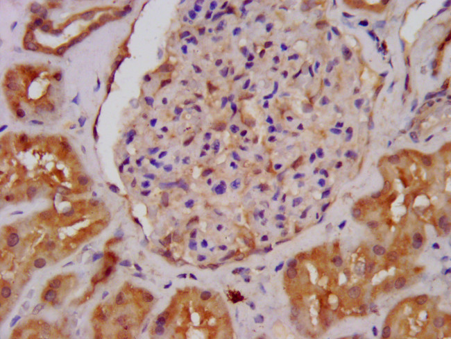 ALDH7A1 Antibody in Immunohistochemistry (Paraffin) (IHC (P))