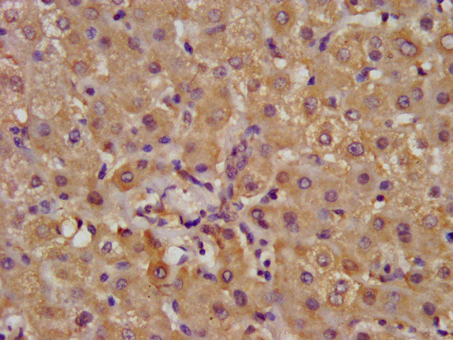 ALDH7A1 Antibody in Immunohistochemistry (Paraffin) (IHC (P))