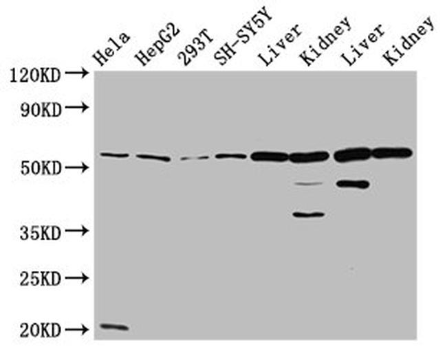 ALDH7A1 Antibody in Western Blot (WB)