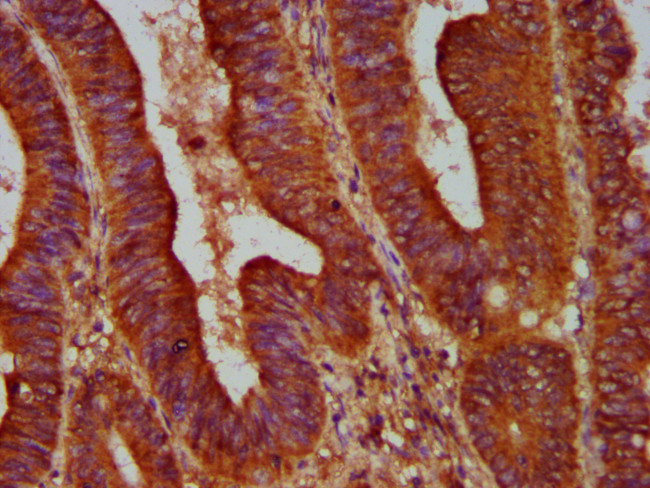 ALOX12 Antibody in Immunohistochemistry (Paraffin) (IHC (P))