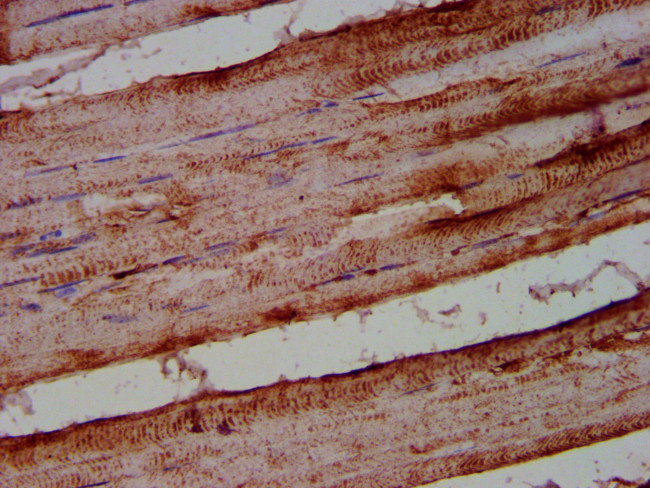 ALOX12 Antibody in Immunohistochemistry (Paraffin) (IHC (P))