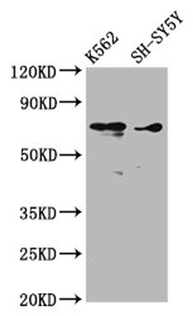 ALOX12 Antibody in Western Blot (WB)