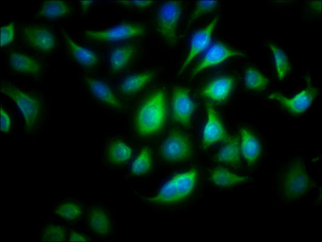 ALOX15B Antibody in Immunocytochemistry (ICC/IF)