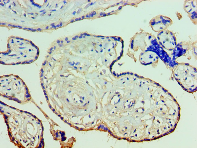 Annexin A11 Antibody in Immunohistochemistry (Paraffin) (IHC (P))