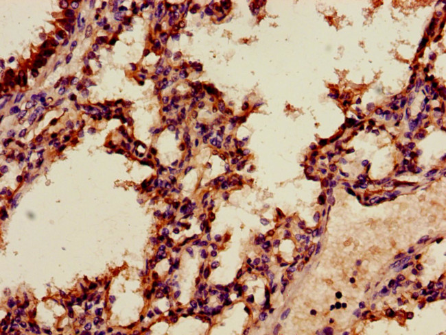 Annexin A2 Antibody in Immunohistochemistry (Paraffin) (IHC (P))