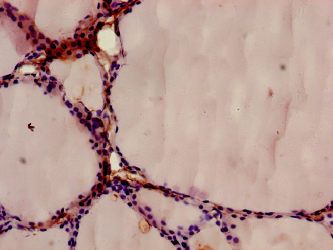 Annexin A9 Antibody in Immunohistochemistry (Paraffin) (IHC (P))