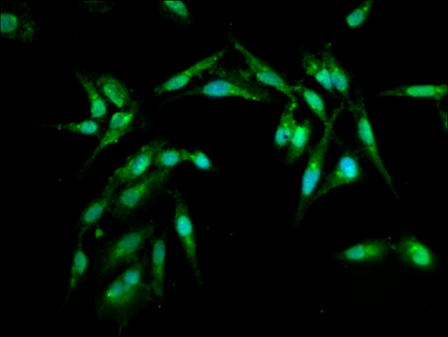 ARL1 Antibody in Immunocytochemistry (ICC/IF)