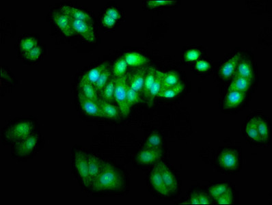 beta Arrestin 1 Antibody in Immunocytochemistry (ICC/IF)