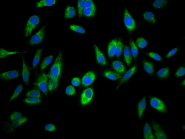 ASPH Antibody in Immunocytochemistry (ICC/IF)