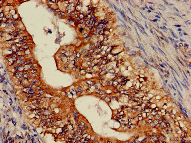 ASTN2 Antibody in Immunohistochemistry (Paraffin) (IHC (P))