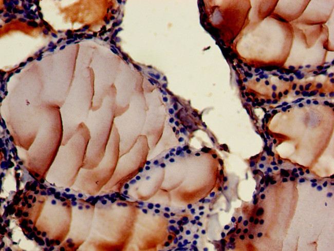 ASTN2 Antibody in Immunohistochemistry (Paraffin) (IHC (P))