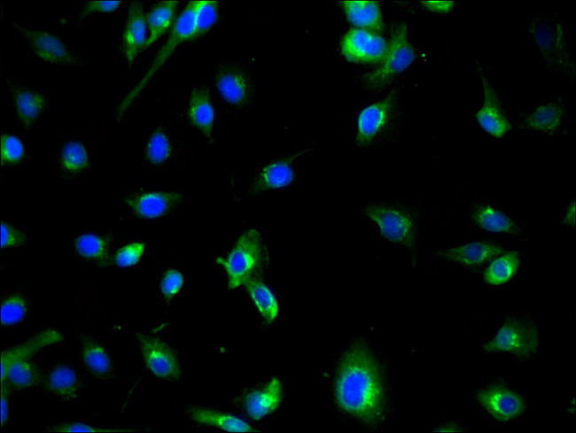 ATG7 Antibody in Immunocytochemistry (ICC/IF)