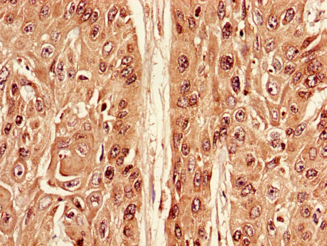 ATG7 Antibody in Immunohistochemistry (Paraffin) (IHC (P))