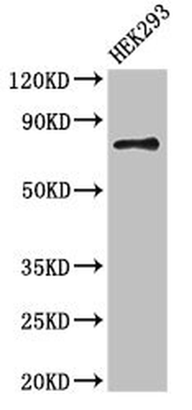 ATG7 Antibody in Western Blot (WB)