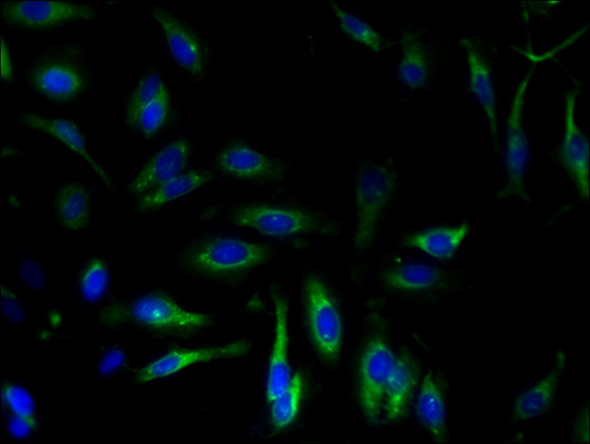 SERCA2 ATPase Antibody in Immunocytochemistry (ICC/IF)