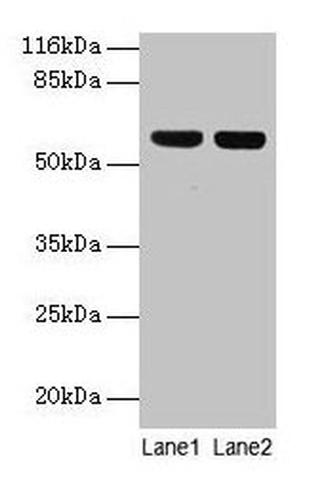 ATP5A1 Antibody in Western Blot (WB)