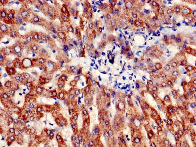 ATP Synthase beta Antibody in Immunohistochemistry (Paraffin) (IHC (P))