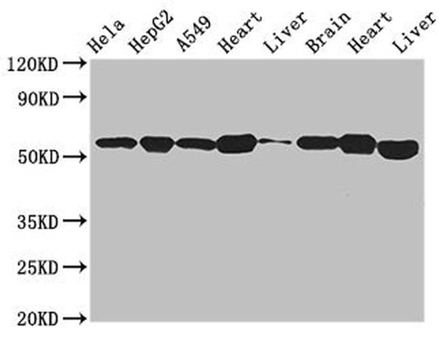 ATP Synthase beta Antibody in Western Blot (WB)