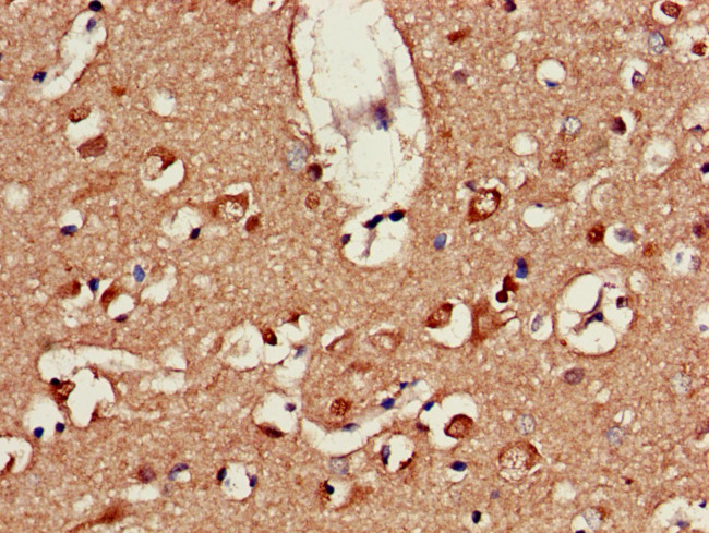 ATP9A Antibody in Immunohistochemistry (Paraffin) (IHC (P))