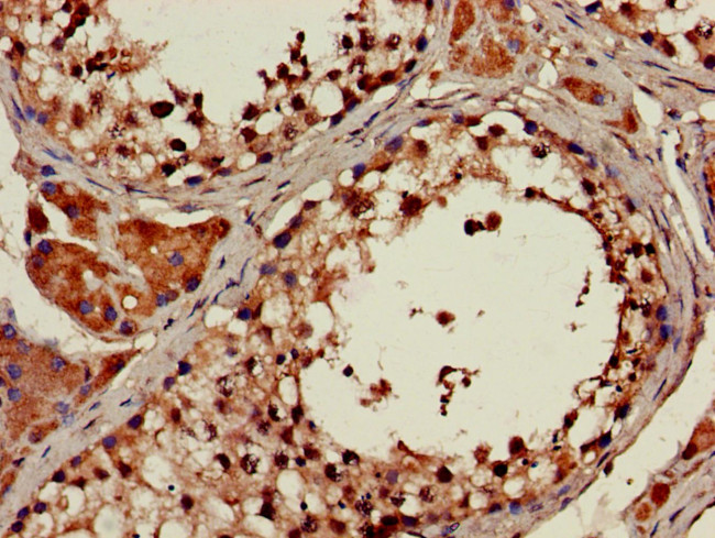 ATP9A Antibody in Immunohistochemistry (Paraffin) (IHC (P))