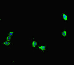 Aurora A Antibody in Immunocytochemistry (ICC/IF)