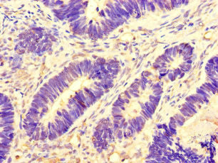 Aurora A Antibody in Immunohistochemistry (Paraffin) (IHC (P))