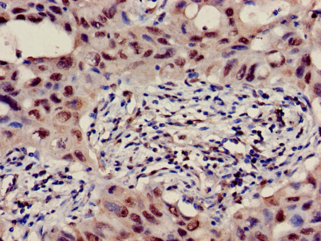 B3GALT4 Antibody in Immunohistochemistry (Paraffin) (IHC (P))