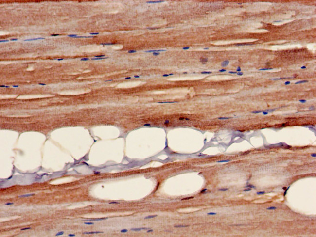 B3GALT4 Antibody in Immunohistochemistry (Paraffin) (IHC (P))