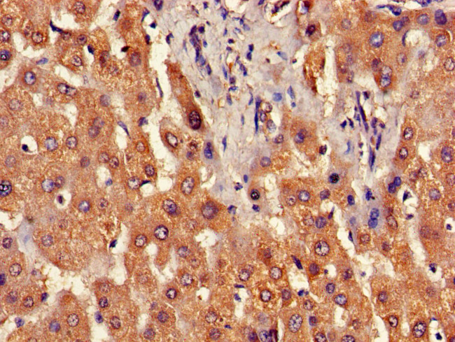 B3GNT2 Antibody in Immunohistochemistry (Paraffin) (IHC (P))