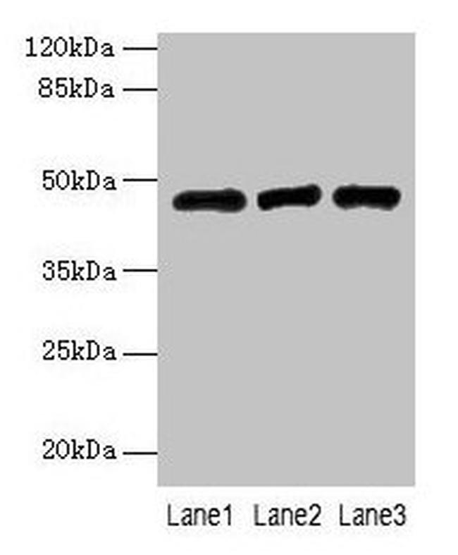 B3GNT2 Antibody in Western Blot (WB)