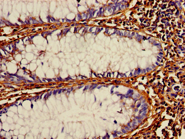 PDI Antibody in Immunohistochemistry (Paraffin) (IHC (P))