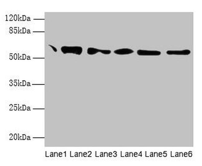 PDI Antibody in Western Blot (WB)