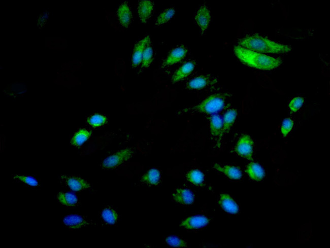 p130Cas Antibody in Immunocytochemistry (ICC/IF)