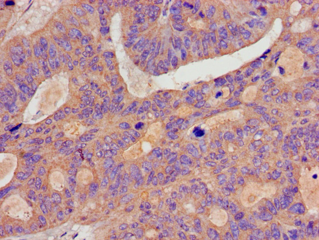 p130Cas Antibody in Immunohistochemistry (Paraffin) (IHC (P))