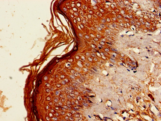 BCAT2 Antibody in Immunohistochemistry (Paraffin) (IHC (P))