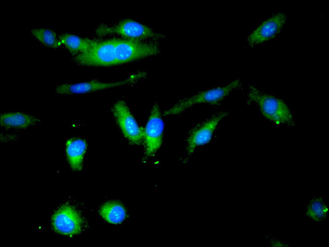 Butyrylcholinesterase Antibody in Immunocytochemistry (ICC/IF)