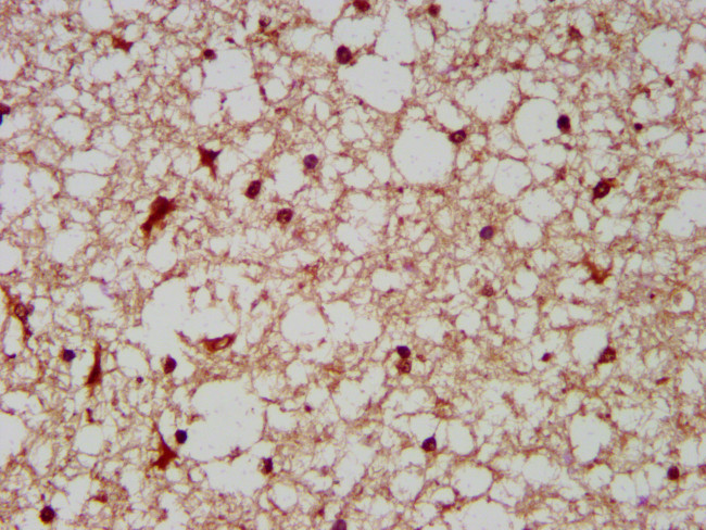 BCKDHA Antibody in Immunohistochemistry (Paraffin) (IHC (P))