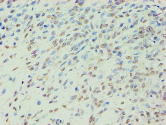 BCKDK Antibody in Immunohistochemistry (Paraffin) (IHC (P))