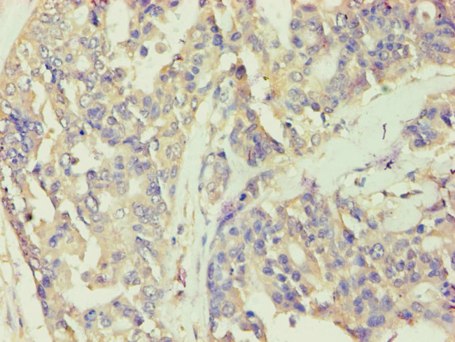 BCKDK Antibody in Immunohistochemistry (Paraffin) (IHC (P))