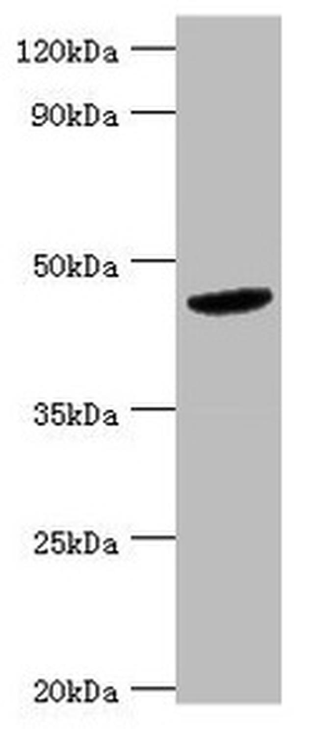 BCKDK Antibody in Western Blot (WB)