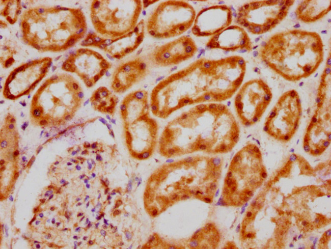 BCL9 Antibody in Immunohistochemistry (Paraffin) (IHC (P))