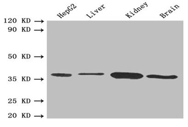 BDH1 Antibody in Western Blot (WB)