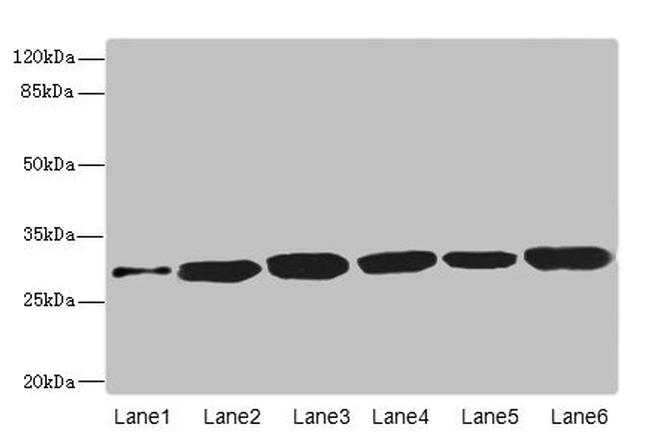 Bisphosphoglycerate mutase Antibody in Western Blot (WB)