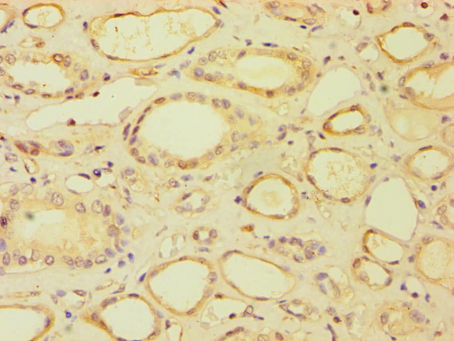 BRCC3 Antibody in Immunohistochemistry (Paraffin) (IHC (P))