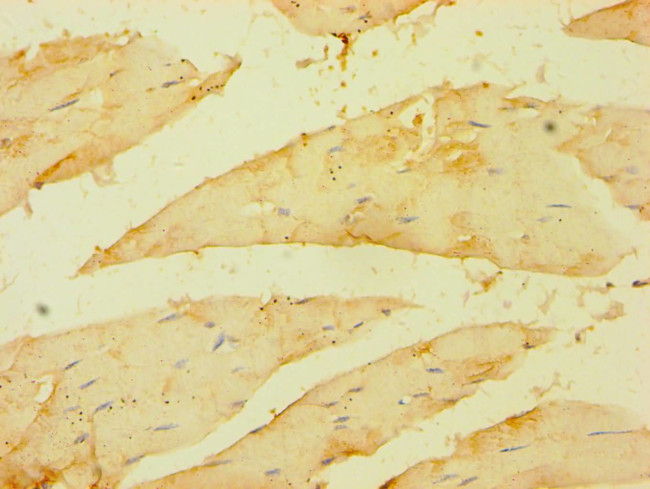 BRCC3 Antibody in Immunohistochemistry (Paraffin) (IHC (P))