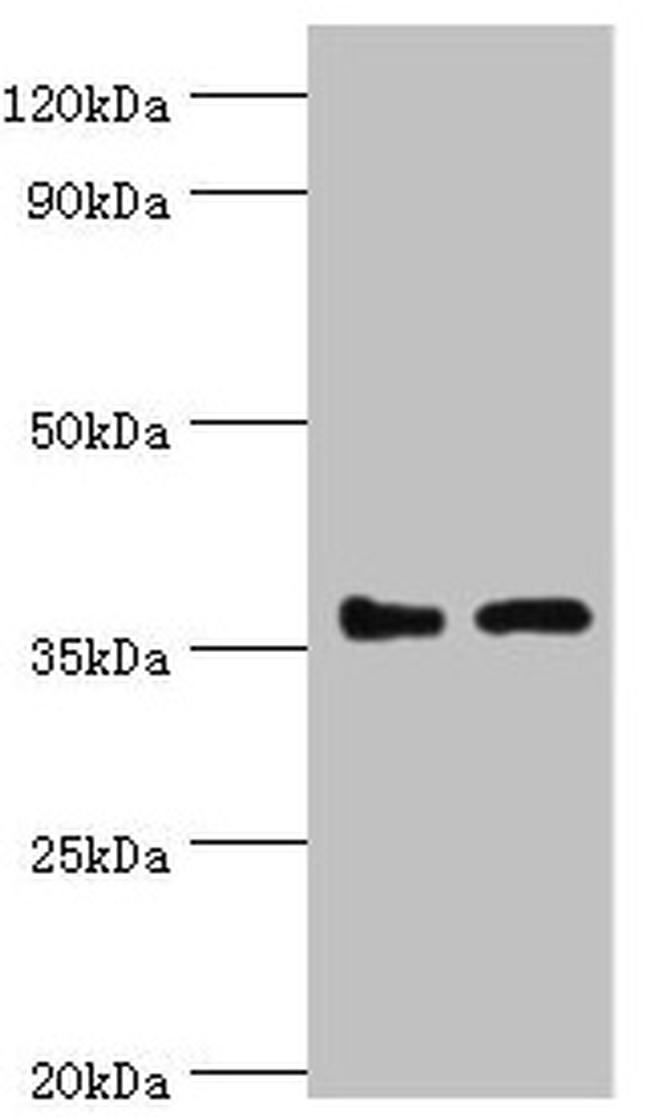 BRCC3 Antibody in Western Blot (WB)