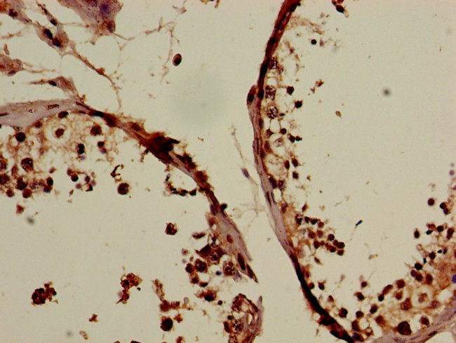 C19orf47 Antibody in Immunohistochemistry (Paraffin) (IHC (P))